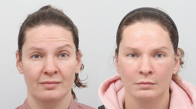 Slider image (5) AB Plastic Surgery